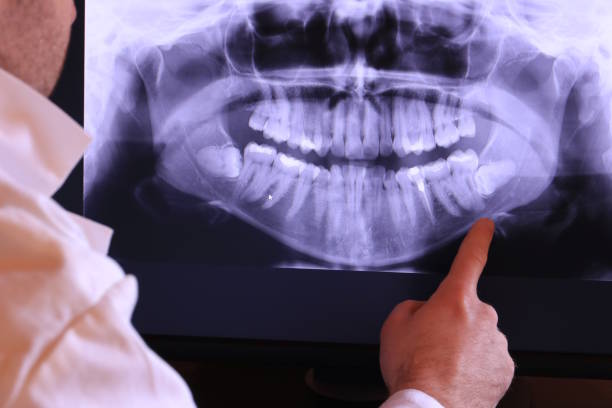 Best Emergency Dental Care for Broken or Chipped Teeth in Mount Vernon, AL