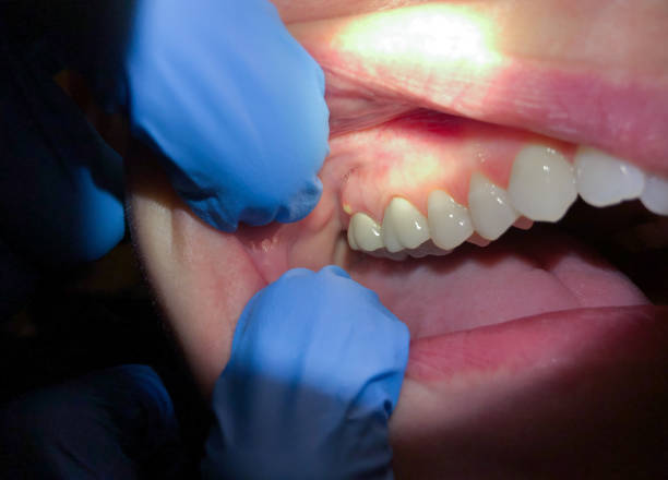 Best Cosmetic Emergency Dentistry in Mount Vernon, AL