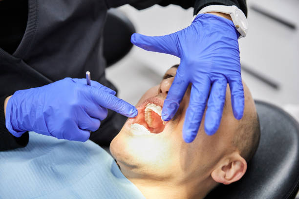Best After-Hours Dental Trauma Care in Mount Vernon, AL
